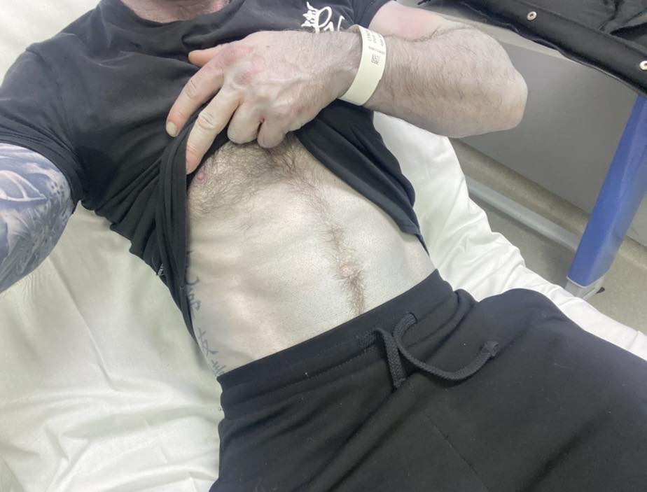 Il corpo blu di Tommy