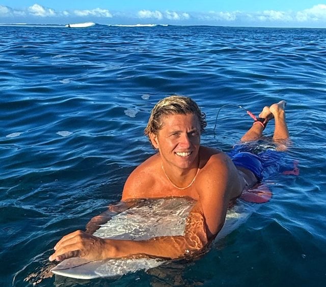 Guy Rowles dopo la sua disavventura