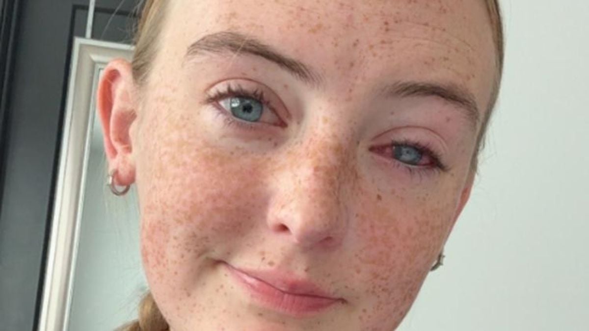 Grace Jamison, giovane donna di 19 anni che ha perso la vista a causa di... una semplice doccia