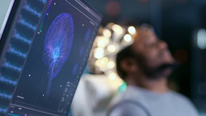 Monitor che mostra un modello grafico del cervello accanto a un paziente