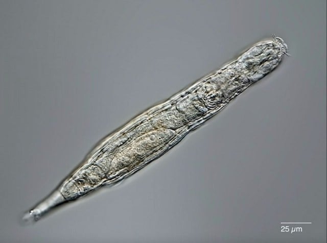 Foto del rotiferi bdelloide