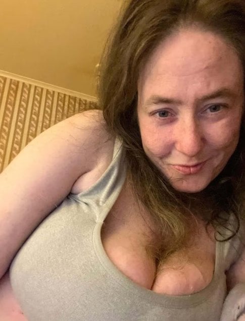 Jayne Stephen prima della sua amputazione