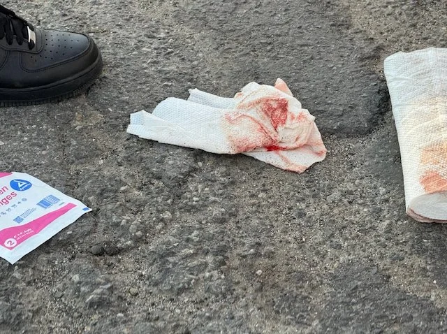 Compresse intrise di sangue dopo l'incidente