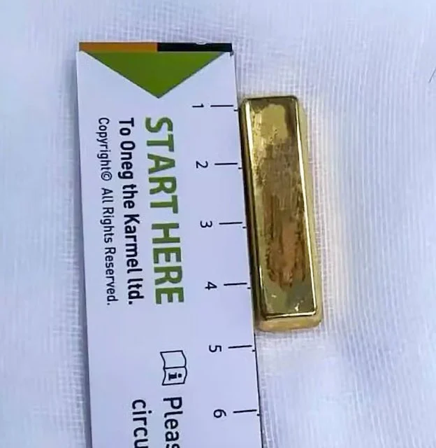 Lingotto d'oro trovato nello stomaco della bambina