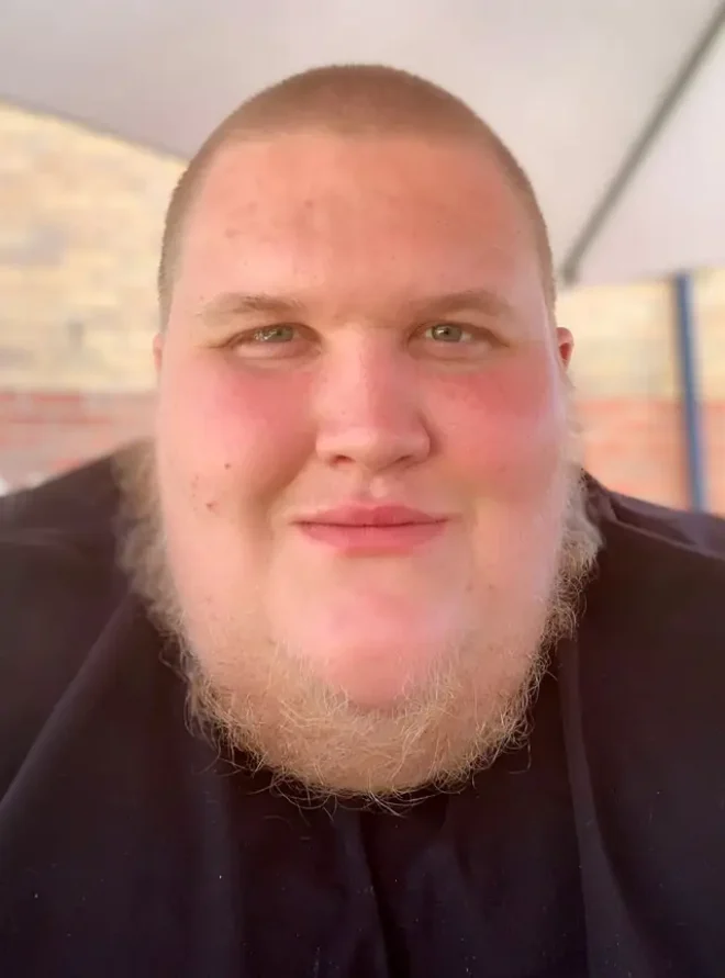 Jack Acko prima della perdita di peso